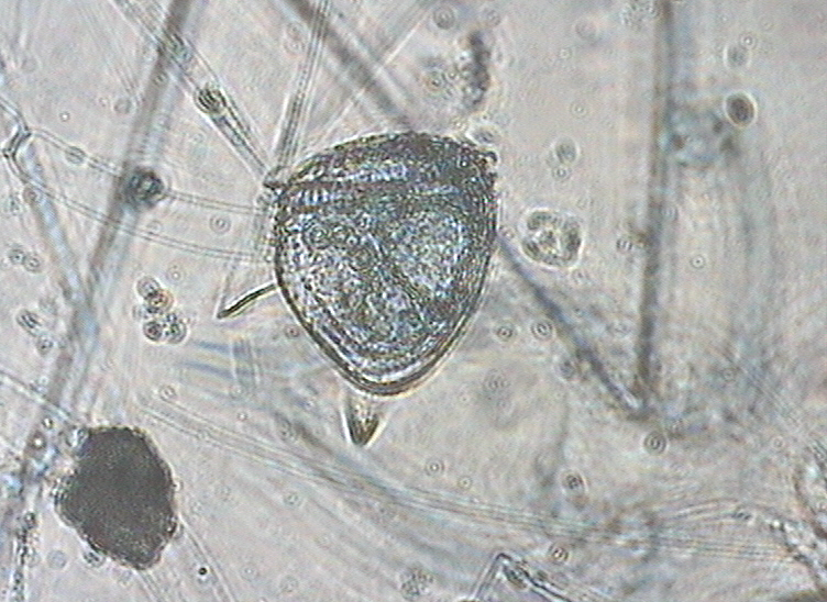 Dictyocha speculum